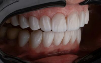 Should You Keep or Toss a First Lost Tooth? Americans Weigh In